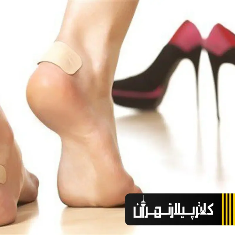 راهکارهایی برای پوشیدن کفش های تنگ_کاترپیلار تهران